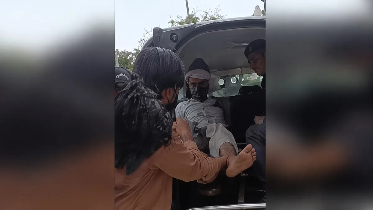 भोपाल: 33 वर्षीय व्यक्ति गंभीर रूप से झुलसा, हड्डियां भी टूटीं